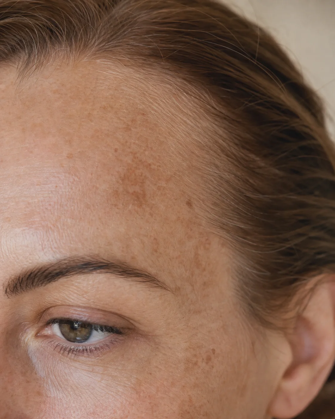 Unebener Hautton als Anwendungsfall für Pure Bright C7 Serum